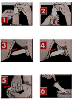 Condoom gebruiksaanwijzing